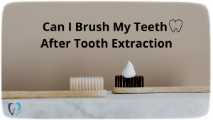 Can I Brush My Teeth After Tooth Extraction